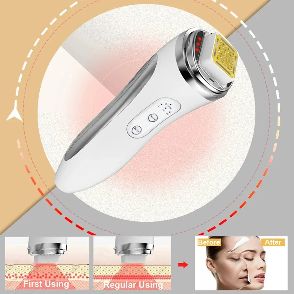 Radio Frequency Facial Lifting Machine Dot Matrix Wrinkle Removal SKin Tightening RF High Frequency Facial Care Massager Device