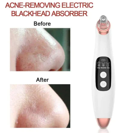 ClearSuction Pro